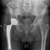 Dokter Dujardin Jan orthopedie heup en knie specialist traumatologie operatie nieuwe knie heup prothese meniscus kruisband sportgeneeskunde izegem hechting kraakbeen operatie chirurg heelkunde arthrose arthritis pijn petré defoort vandendriessche knieprothese heupprothese topdokter arts kunstknie topdokters beste kunstheup topchirurg